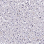 Immunohistochemical staining of human liver shows no positivity in hepatocytes as expected.