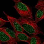 Immunofluorescent staining of human cell line SH-SY5Y shows localization to nucleus & nuclear membrane.