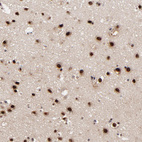 Anti-RBM22 Antibody