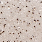 Immunohistochemical staining of human cerebral cortex shows strong nuclear positivity in neurons.