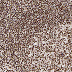 Anti-RBM22 Antibody