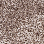 Immunohistochemical staining of human tonsil shows strong nuclear positivity in non-germinal and germinal center cells.