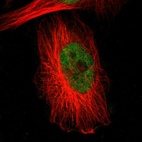 Anti-RBM22 Antibody