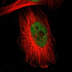 Immunofluorescent staining of human cell line U-251 MG shows localization to nucleus.