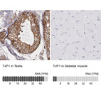 Anti-TJP1 Antibody