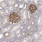 Immunohistochemical staining of human kidney shows strong membranous positivity in cells in glomeruli.