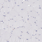 Immunohistochemical staining of human skeletal muscle shows no membranous positivity in myocytes as expected.