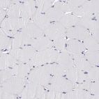 Immunohistochemical staining of human skeletal muscle shows no membranous positivity in myocytes as expected.