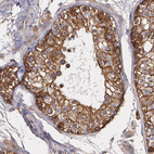 Anti-TJP1 Antibody