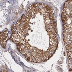 Immunohistochemical staining of human testis shows moderate to strong membranous positivity in cells in seminiferous ducts.