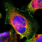 Immunofluorescent staining of human cell line U-2 OS shows localization to cytosol & cell junctions.