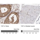 Anti-TJP1 Antibody