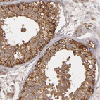 Immunohistochemical staining of human testis shows strong membranous and cytoplasmic positivity in cells in seminiferous ducts.
