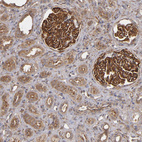 Immunohistochemical staining of human kidney shows strong membranous and cytoplasmic positivity in cells in glomeruli.