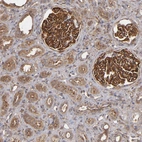 Immunohistochemical staining of human kidney shows strong membranous and cytoplasmic positivity in cells in glomeruli.