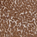 Immunohistochemical staining of human liver shows strong cytoplasmic positivity in hepatocytes.