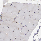 Immunohistochemical staining of human skeletal muscle shows negative cytoplasmic positivity in myocytes as expected.