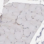 Immunohistochemical staining of human skeletal muscle shows negative cytoplasmic positivity in myocytes as expected.