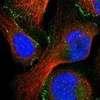 Immunofluorescent staining of human cell line U-2 OS shows localization to cytosol & cell junctions.
