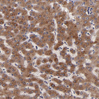 Anti-RBP4 Antibody