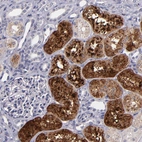 Immunohistochemical staining of human kidney shows strong cytoplasmic positivity in cells in tubules.