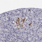 Immunohistochemical staining of human pancreas shows strong cytoplasmic positivity in islets of Langerhans.