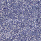 Anti-RBP4 Antibody