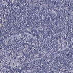 Immunohistochemical staining of human tonsil shows no positivity in non-germinal center cells as expected.