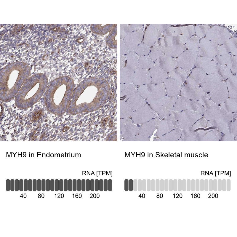 Anti-MYH9 Antibody