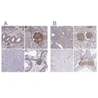 Immunohistochemical staining of human endometrium, kidney, skeletal muscle and testis using Anti-MYH9 antibody HPA001644 (A) shows similar protein distribution across tissues to independent antibody HPA064783 (B).