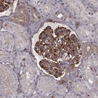 Immunohistochemical staining of human kidney shows strong cytoplasmic positivity in cells in glomeruli.
