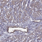 Immunohistochemical staining of human smooth muscle shows moderate cytoplasmic positivity muscles fibres and in endothelial cells.