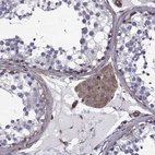 Immunohistochemical staining of human testis shows strong cytoplasmic and membranous positivity in Leydig cells.