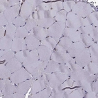 Immunohistochemical staining of human skeletal muscle shows no positivity in myocytes as expected.