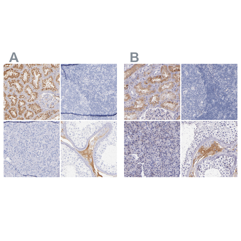 Anti-KNG1 Antibody