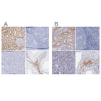 Anti-KNG1 Antibody