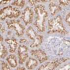 Immunohistochemical staining of human kidney shows strong granular cytoplasmic positivity in cells in tubules.