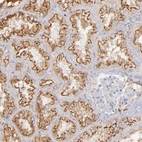 Immunohistochemical staining of human kidney shows strong granular cytoplasmic positivity in cells in tubules.