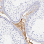 Immunohistochemical staining of human testis shows strong positivity in plasma.