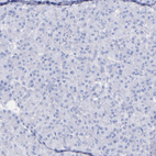 Immunohistochemical staining of human pancreas shows no positivity in exocrine glandular cells as expected.