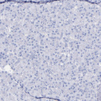 Anti-KNG1 Antibody