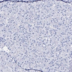 Immunohistochemical staining of human pancreas shows no positivity in exocrine glandular cells as expected.