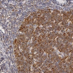 Immunohistochemical staining of human tonsil shows moderate cytoplasmic positivity in germinal center cells.