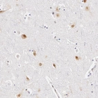 Immunohistochemical staining of human cerebral cortex shows moderate nuclear positivity in neurons.