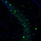 Anti-DDX3X Antibody