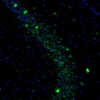 Immunofluorescence staining of mouse hippocampus shows moderate positivity in a subset of neurons in the brain.