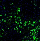 Immunofluorescence staining of mouse medulla shows strong positivity in neurons of the facial nucleus.