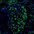 Immunofluorescence staining of mouse thalamus shows moderate positivity in neurons of the anterodorsal thalamic nucleus.