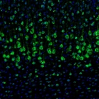 Immunofluorescence staining of mouse cerebral cortex shows strong positivity in neurons in the parietal association cortex.