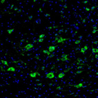 Anti-DDX3X Antibody